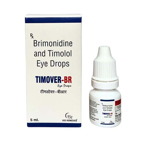 Brimonide and Timolol Eye Drops